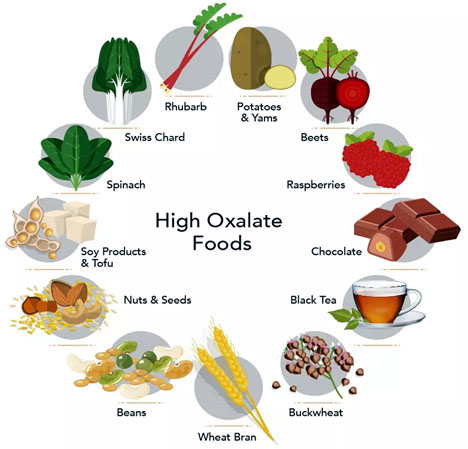 Calcium Oxalate Food Chart